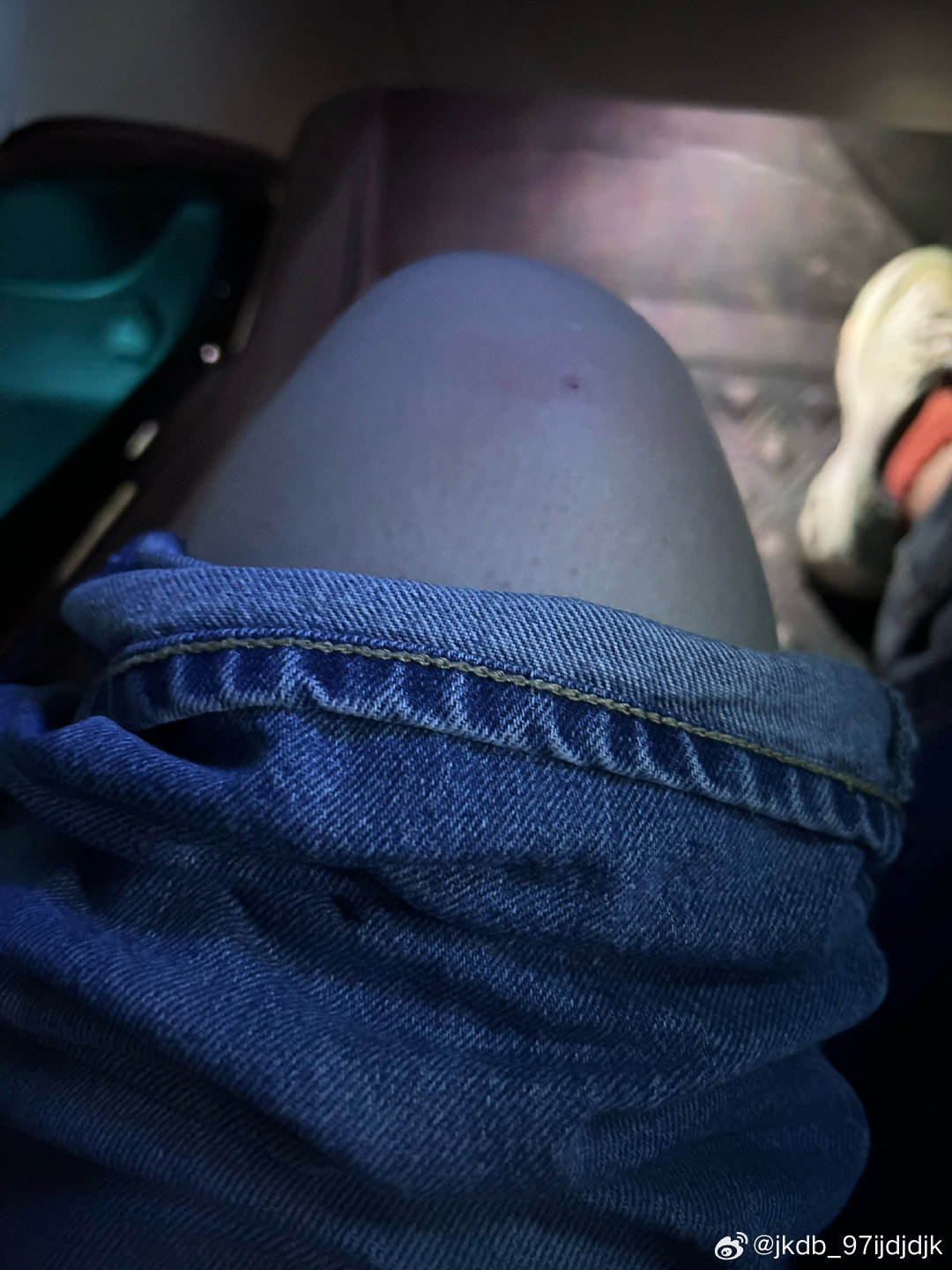 腿被烧烤签子扎了，怎么办？