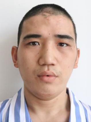 被强送精神病院的阴影，案例解读与反思