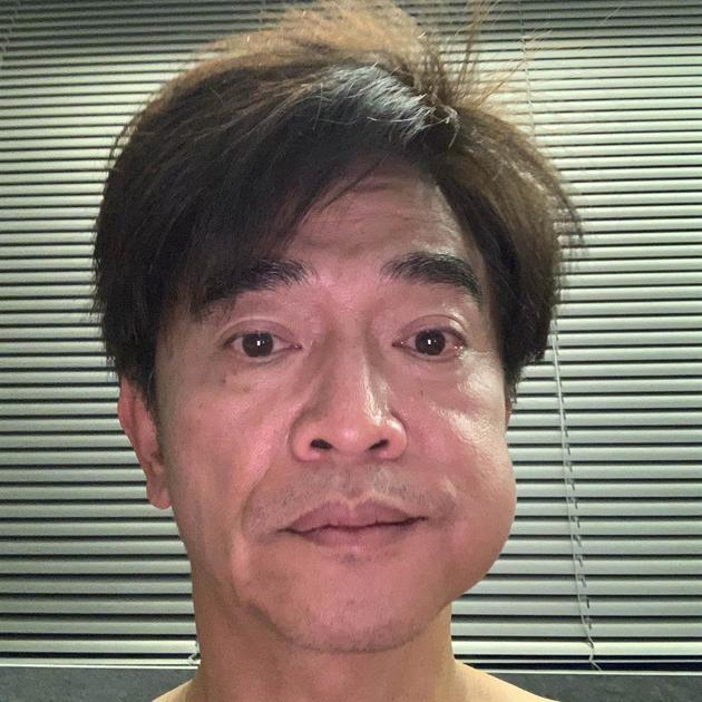 警钟长鸣，31岁男子拔牙后离世事件深度剖析