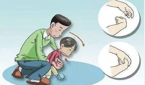 误吞东西，一次意外的经历与教训