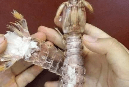 剥虾被扎了怎么办？全面指南帮你解决烦恼