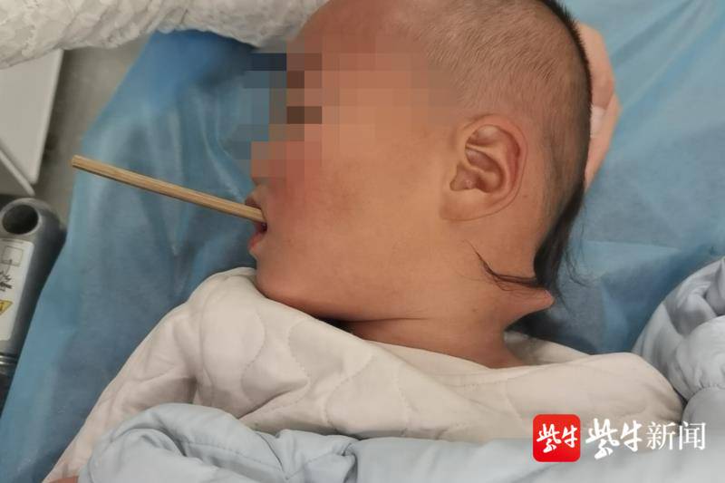 小孩被筷子戳穿事件，深度分析与反思