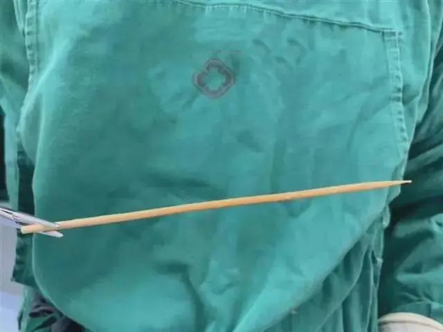 烧烤狂欢后的危机处理指南，烧烤签子扎到喉咙里怎么办？