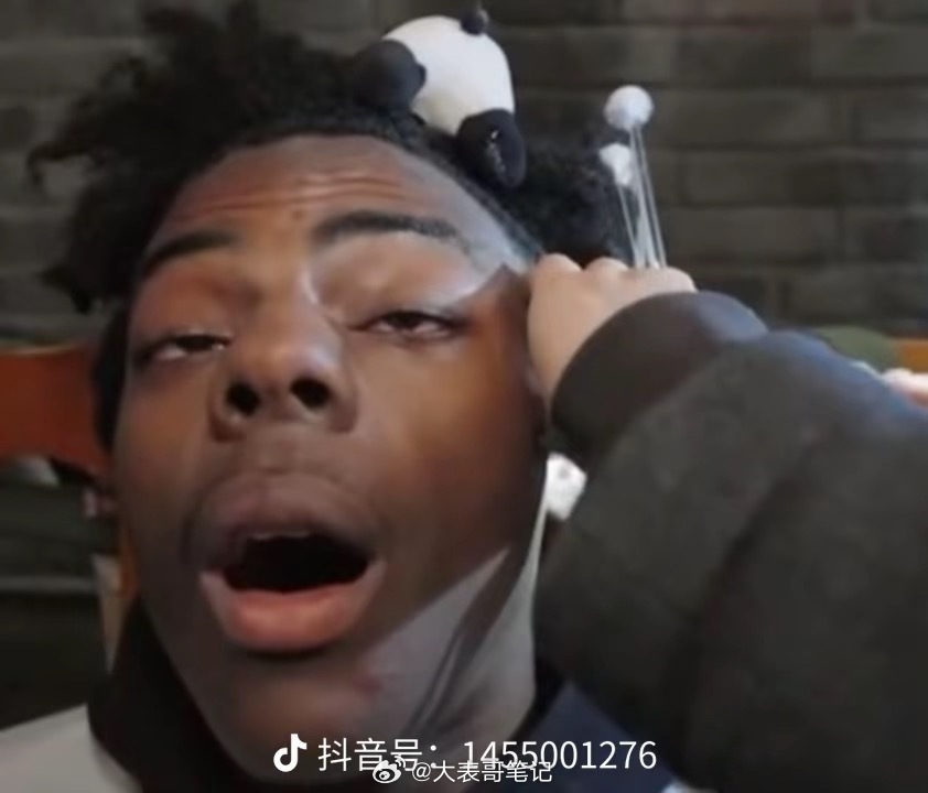 甲亢哥首次邂逅熊猫，激动之情溢于言表，夹子音再现