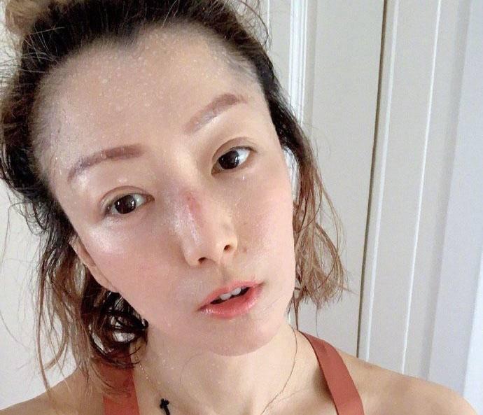 男人去拔罐，是不是出轨了？