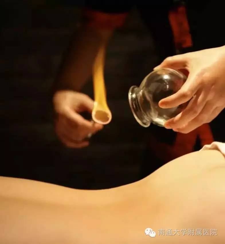 男子拔罐时意外着火，老板回应引争议