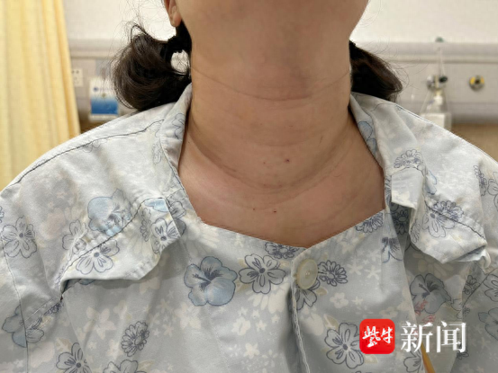 年轻女孩甲亢，了解、关注与应对