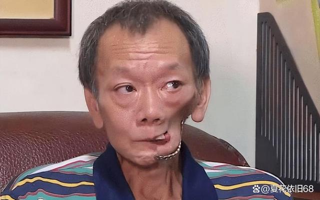 甲亢哥槟榔之痛，一次痛苦的体验之旅