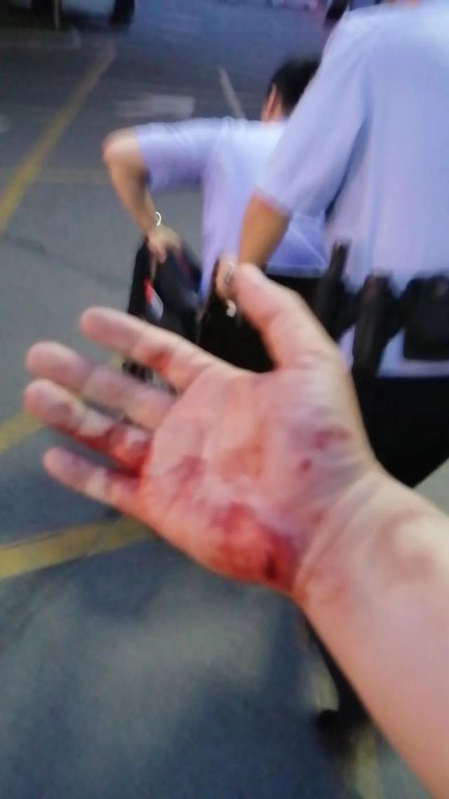在家做实验被炸伤男生手部截肢，警示与反思