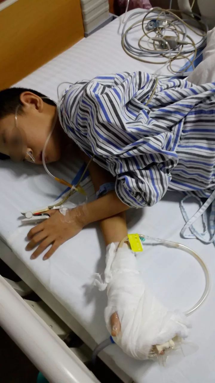 在家做实验被炸伤男生手部截肢，警示与反思