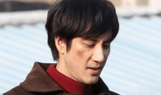 王力宏脸部被烧伤事件深度解析