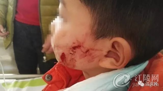 惊魂一刻，7岁男孩遭遇犬群袭击事件深度剖析