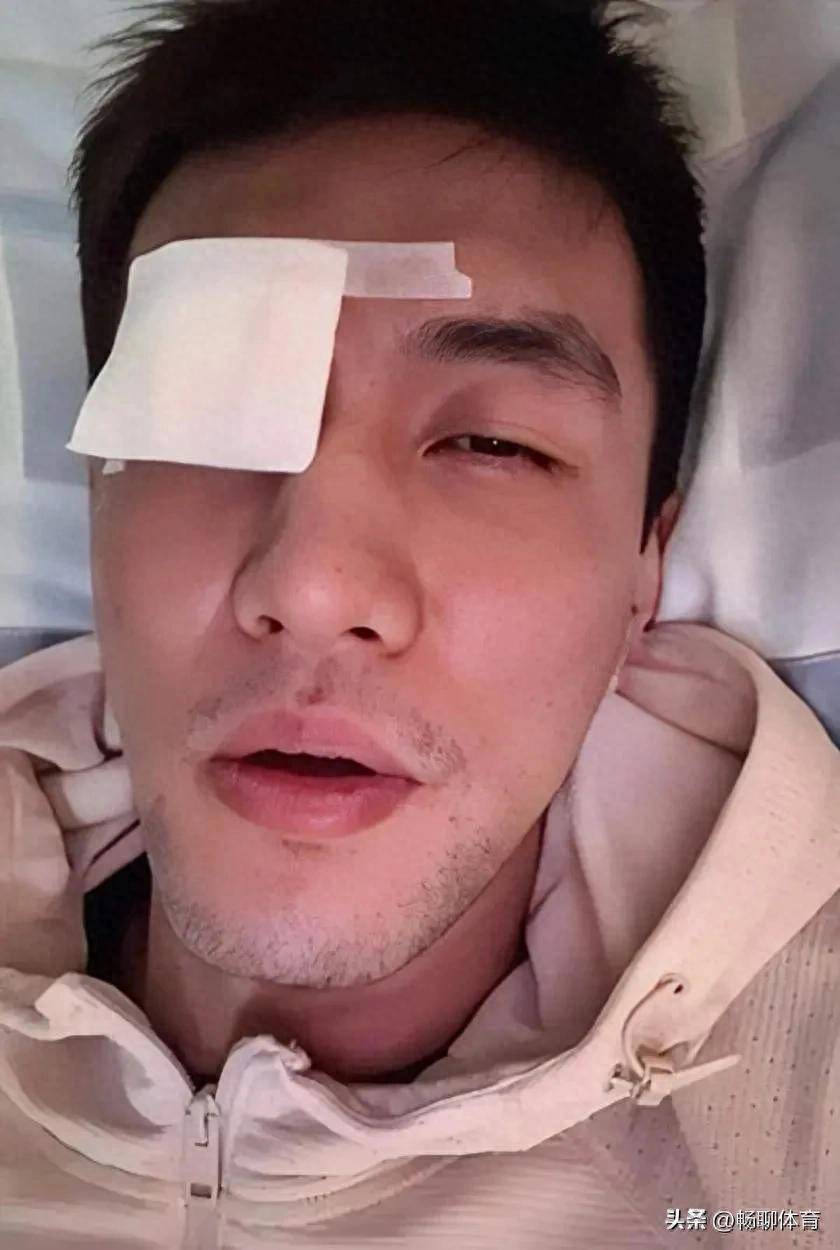 郭艾伦首次回应眼睛受伤，伤病困扰与坚韧斗志的交织