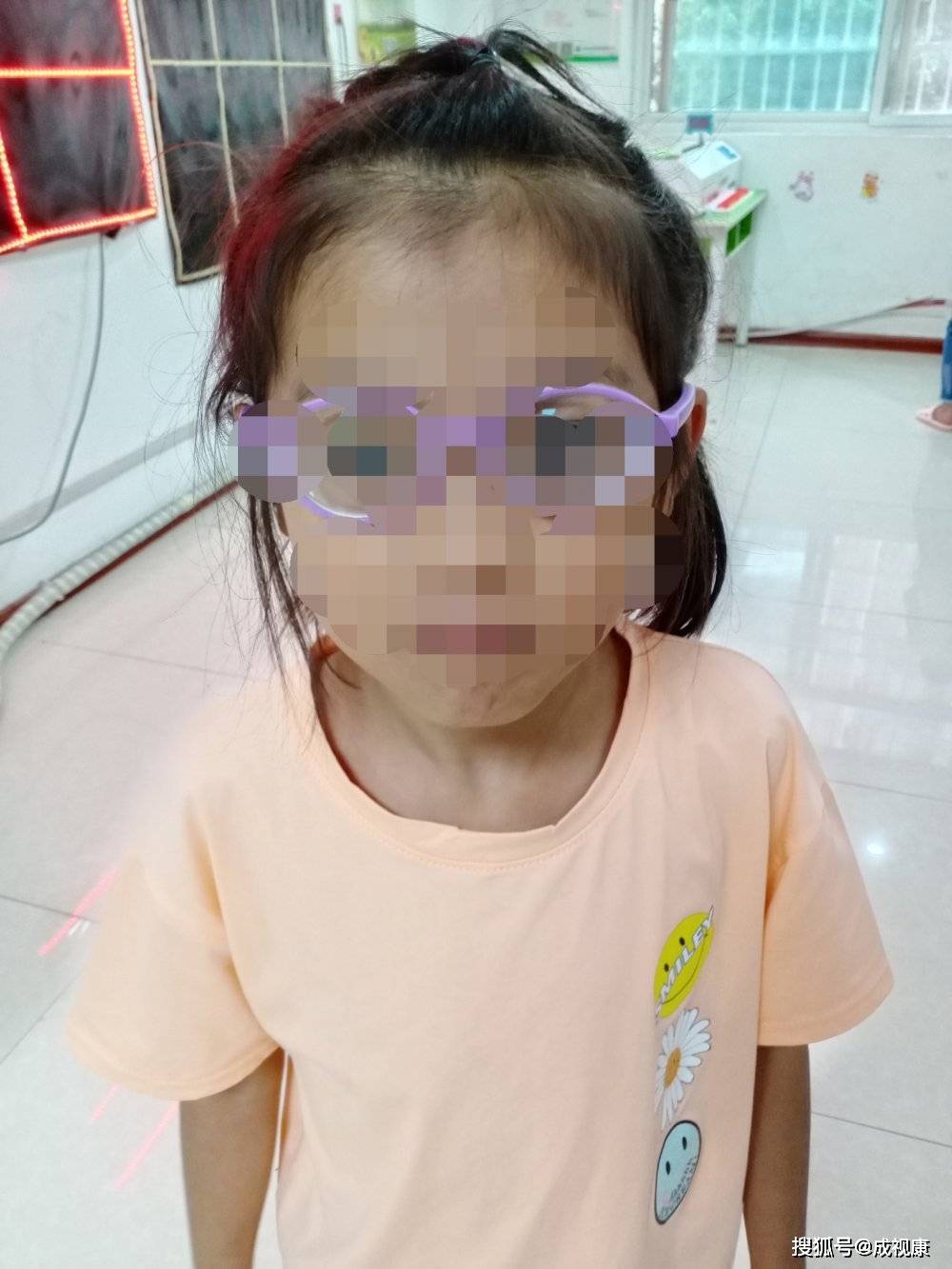7岁女孩视力骤降，关注儿童眼健康刻不容缓