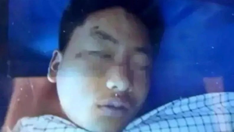 男子被打20个月后死亡，凶手判一年半背后的深思