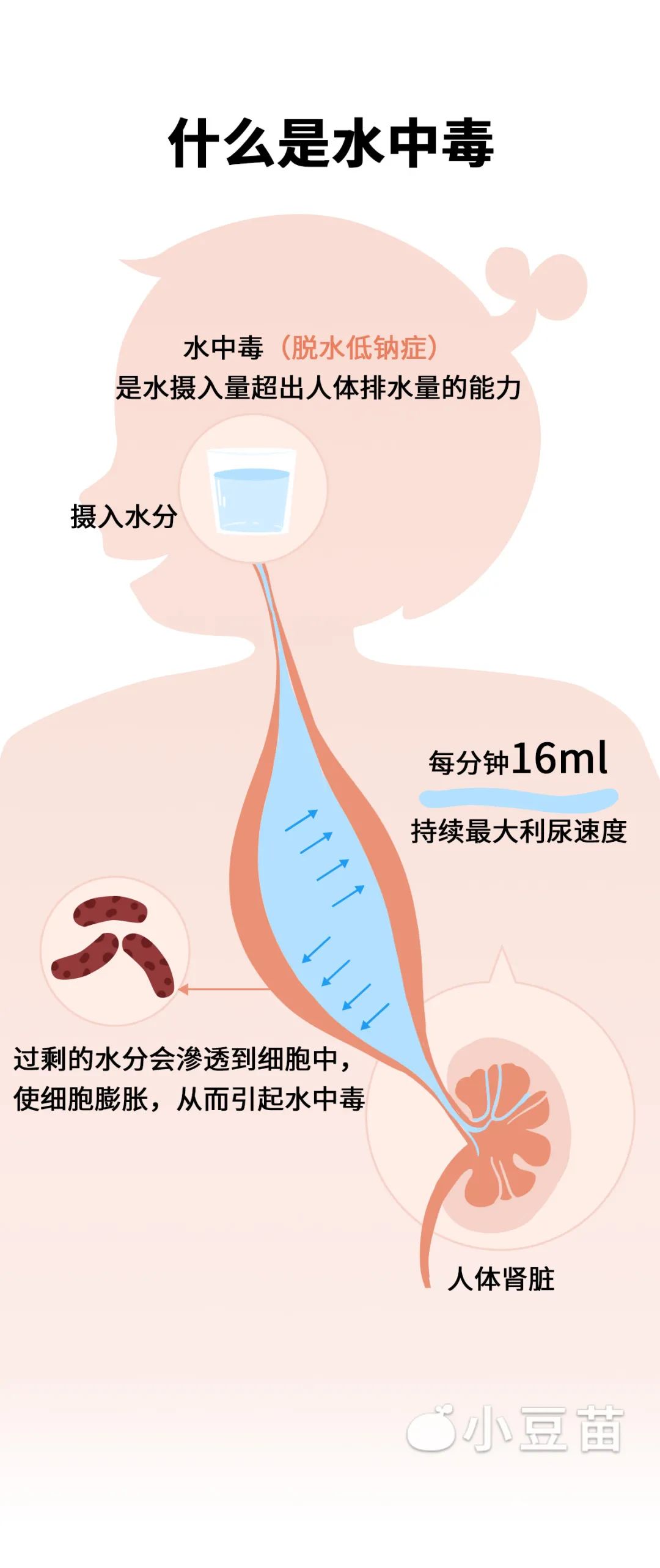 揭秘3小时喝8杯水中毒真相