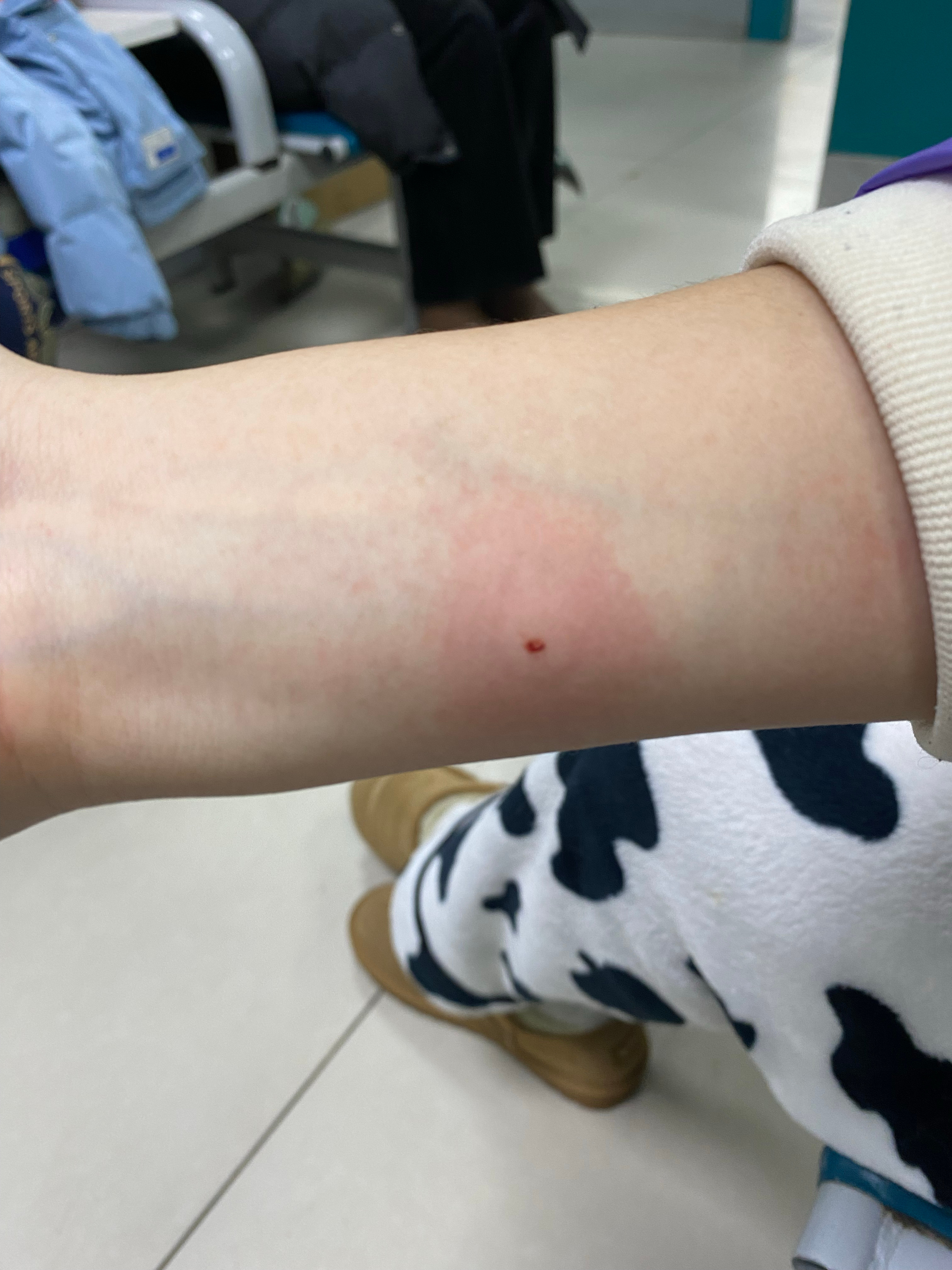 输液头孢过敏对身体危害大吗？全面解析