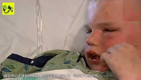 被蜜蜂蜇的小孩，一次意外的成长经历
