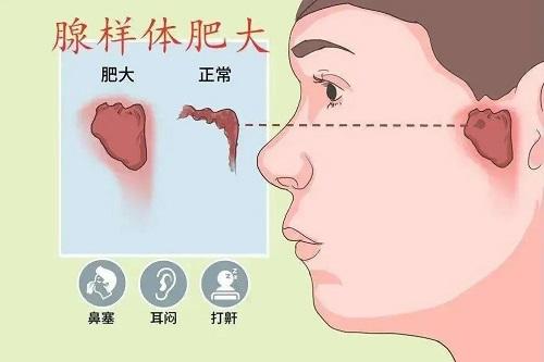 打呼噜有哪些危害