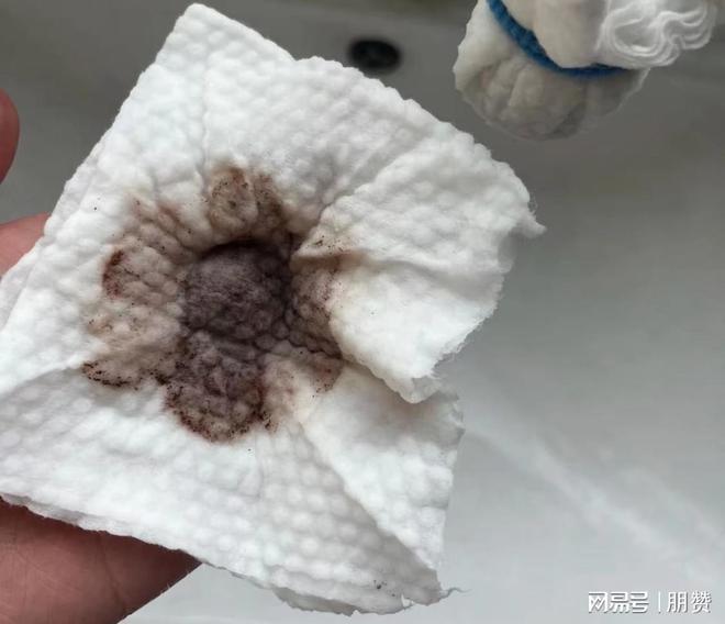 自来水中有虫卵吗？探究水质安全的真相