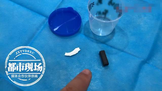误吞一次性勺子，一次意外的健康警示